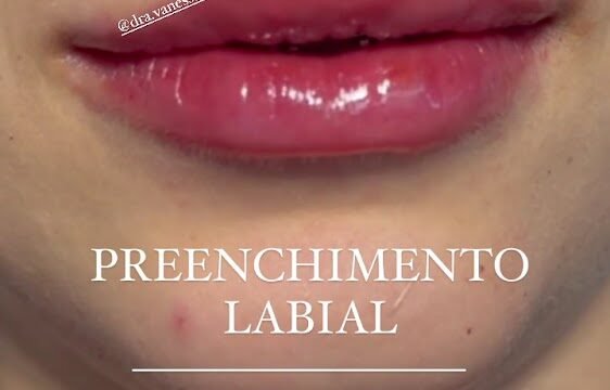 CLINICA DA PELE DERMATOLOGIA-LASER em Janaúba