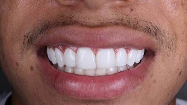 Dr. Premium -Clínicas odontológicas em Janaúba em Janaúba