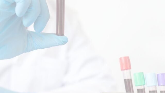 Laboratório de Análises Clínicas Apoteke – Posto de Coleta em Janaúba