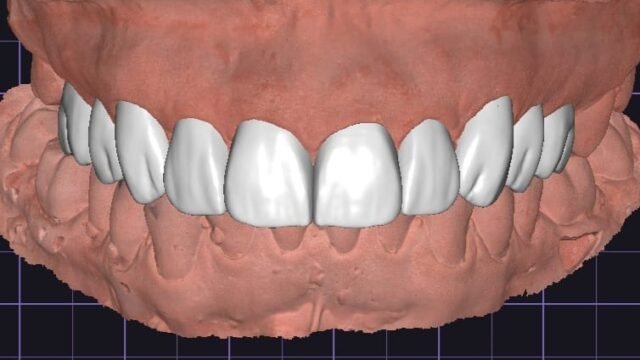 Laboratório digital de prótese odontológica Gean Mendes em Janaúba