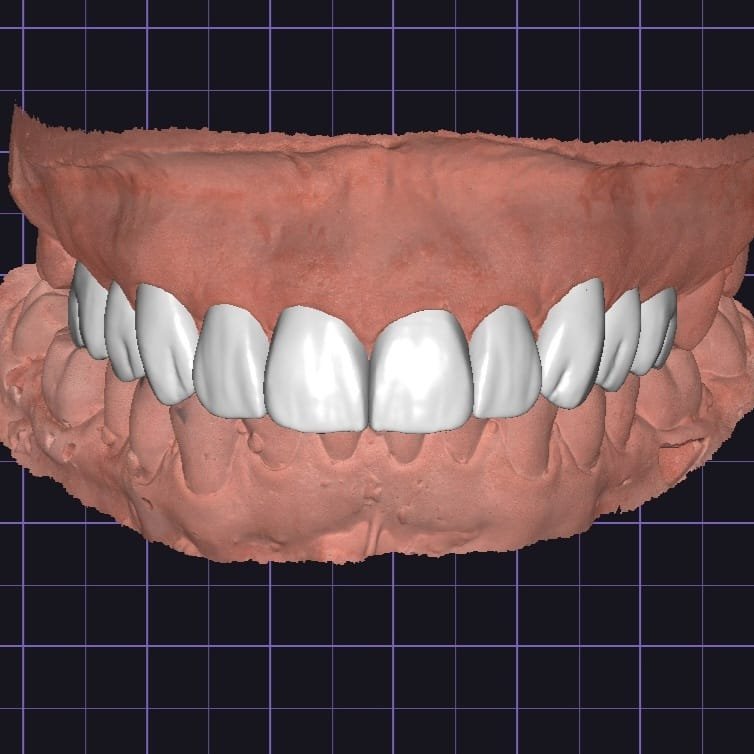 Laboratório digital de prótese odontológica Gean Mendes – Outros Serviços em Janaúba