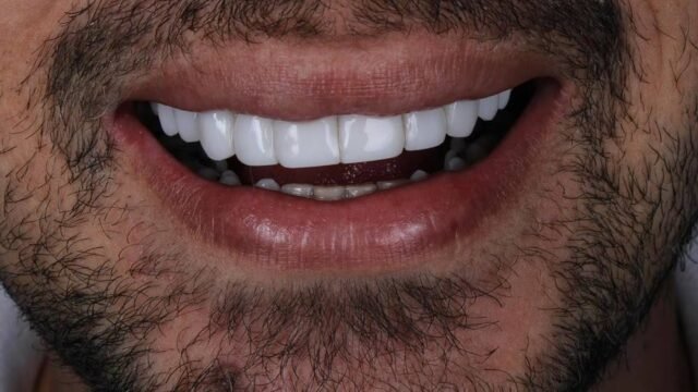 Odonto Centter – Dentista em Janaúba MG em Janaúba